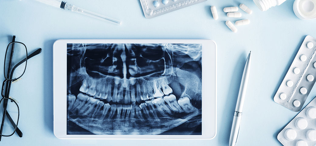 口腔外科イメージ